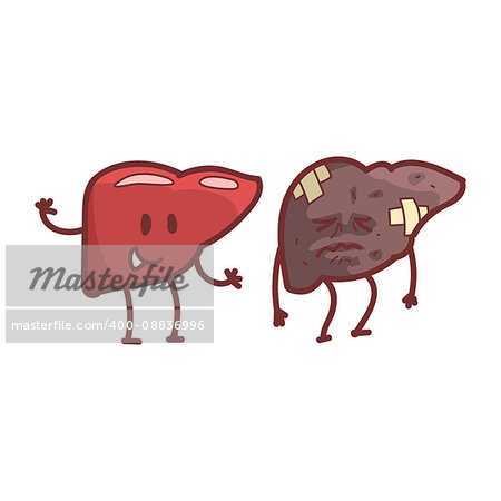 Liver Human Internal Organ Healthy Vs Unhealthy, Medical Anatomic Funny Cartoon Character Pair In Comparison Happy Against Sick And Damaged. Vector Illustration Humanized Anatomic Elements.