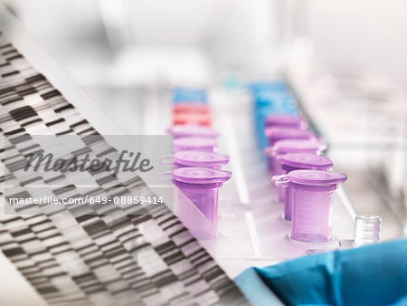 Scientist holding a DNA autoradiogram gel showing genetic information with samples in tray Scientist holding a DNA autoradiogram gel showing genetic information with samples in tray