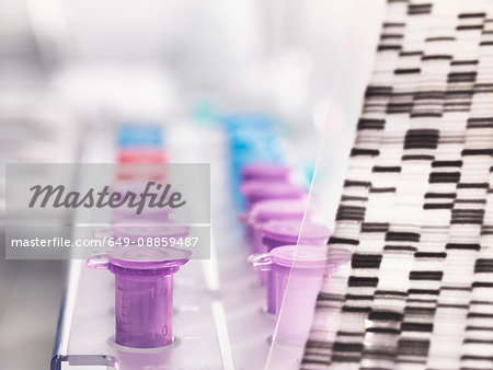 A DNA autoradiogram gel showing genetic information with samples in tray A DNA autoradiogram gel showing genetic information with samples in tray
