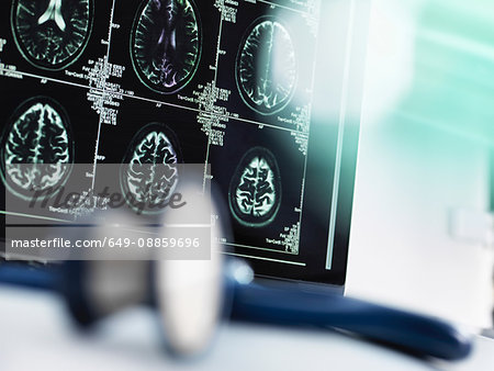 Series of MRI brain scans on computer screen with stethoscope in foreground on doctor's desk