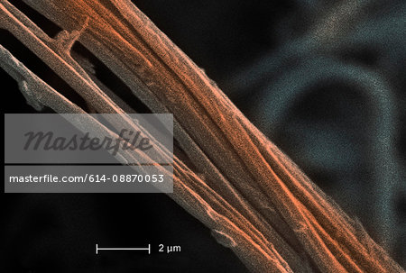 Scanning Electron micrograph of  asbestos, 8000x