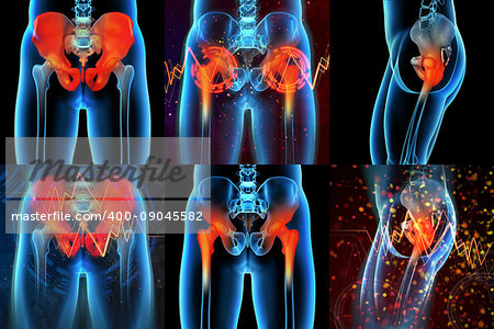 3d rendering  medical illustration of a painful sacrum