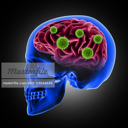 3D render of a male skull with virus cells attacking the brain