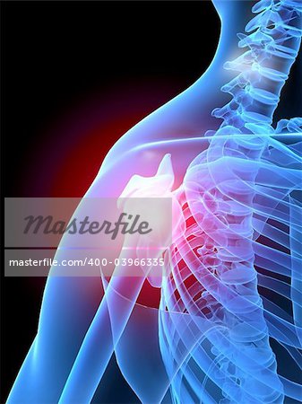 3d rendered x-ray illustration of human painful shoulders