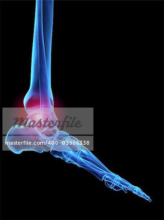 3d rendered x-ray illustration of a human skeletal foot with pain