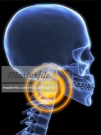 3d rendered x-ray illustration of a human head with neck pain