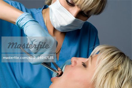 tooth extraction using forceps, special dental instrument for teeth removal