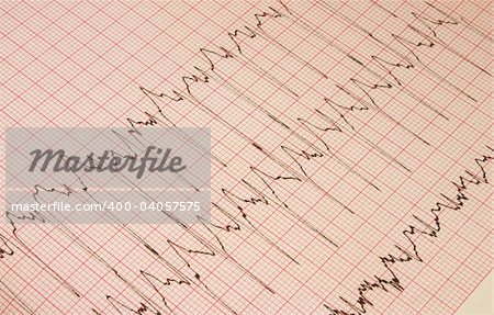 cardiological test results