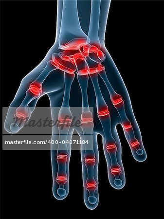 3d rendered illustration of a human skeletal hand with painful joints