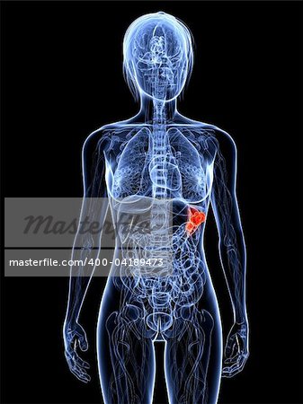 3d rendered illustration of a transparent female body with tumor in spleen