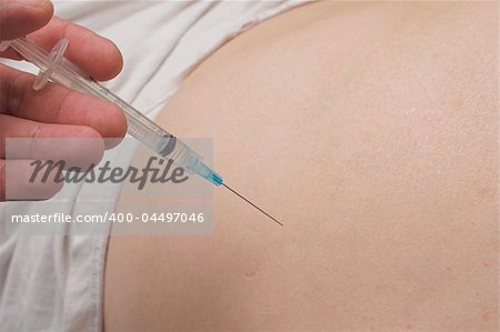 A medical injection into a person's buttocks.