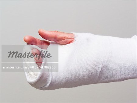 Bandage and cast on hand after injury or surgery, fingers only visible. Isolated on gray.