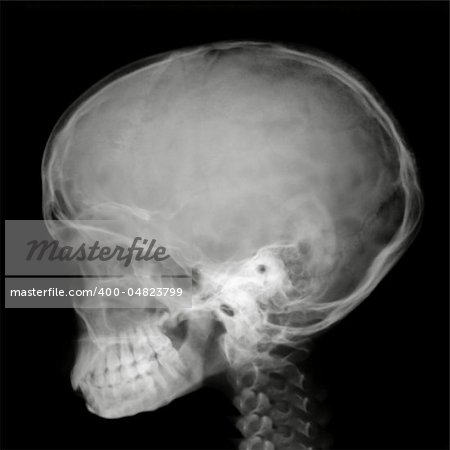 Side view of Human head on x-ray film