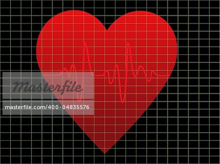 EKG or heart beat monitor