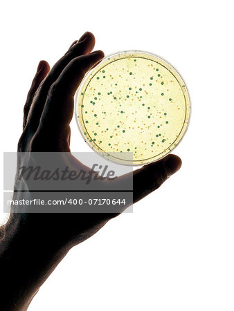 An image of a hand holding a petri dish