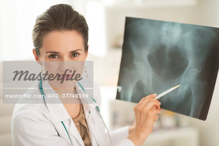 Portrait of doctor woman pointing on fluorography