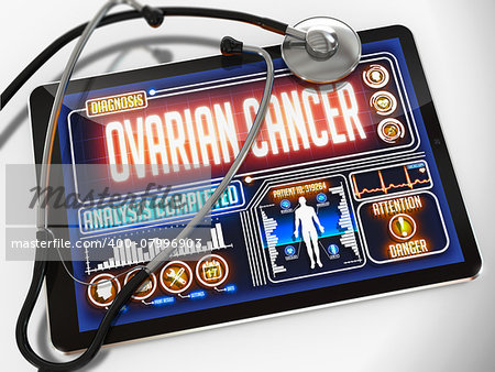 Ovarian Cancer - Diagnosis on the Display of Medical Tablet and a Black Stethoscope on White Background.