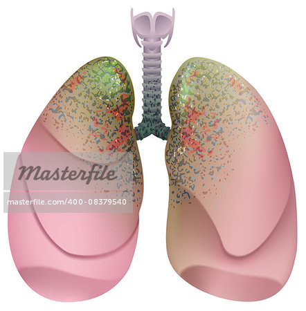 Respiratory system smoker. Lung cancer. Isolated on white vector illustration