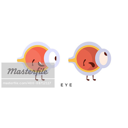 Healthy vs Unhealthy Eye Infographic Illustration.Humanized Human Organs Childish Cartoon Characters On White Background
