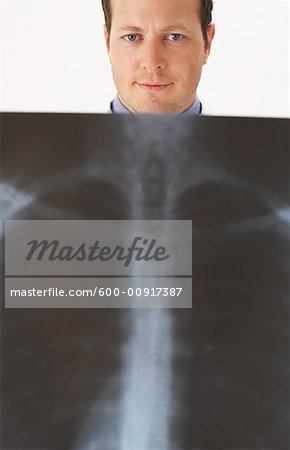 Man Holding Chest X-Ray