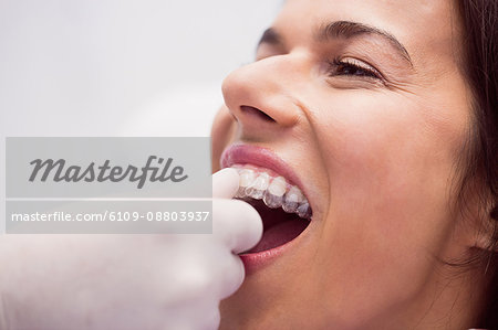 Dentist assisting female patient to wear braces in dental clinic