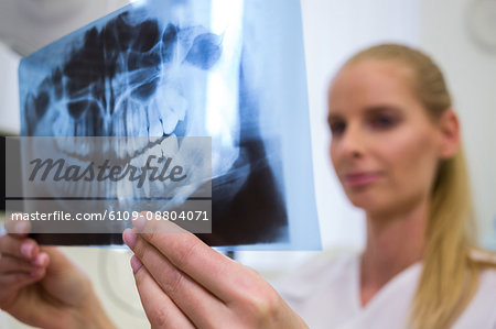 Dentist looking at dental x-ray plate in clinic