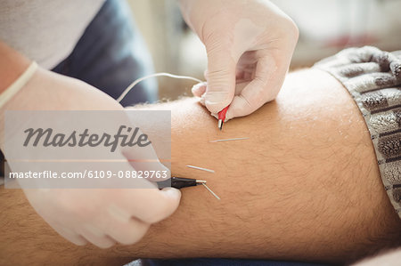 Physiotherapist performing electro dry needling on the knee of a patient
