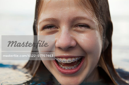 Teenage girl with braces wearing bikini - Stock Photo - Masterfile