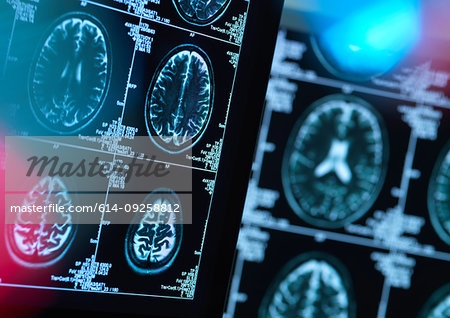 Brain scans of possible disease or damage in clinic