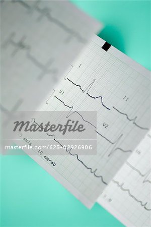 Close-up of an electrocardiogram report