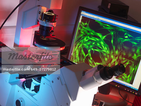 Inverted microscope viewing stem cells in flask with display of a fluorescent labeled cells
