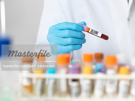 Close up of scientists hands selecting a blood sample for medical testing Close up of scientists hands selecting a blood sample for medical testing
