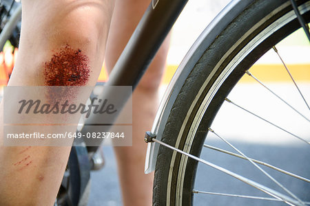 Cropped view of bicycle and girls leg with grazed knee