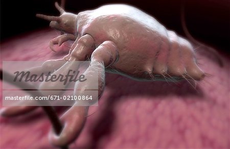 Pubic louse