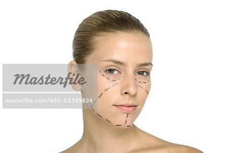 Young woman with plastic surgery markings on face, looking at camera