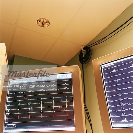 Heart Monitors