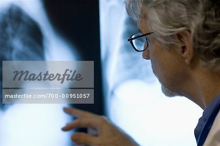 Doctor Looking at X-Ray