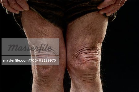 260 Crushed Knees Royalty-Free Photos and Stock Images
