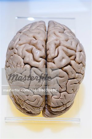 Plastinated Specimen of Human Brain - Stock Photo - Masterfile