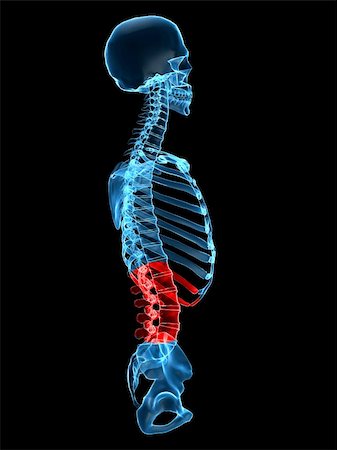 simsearch:400-04008303,k - 3d rendered anatomy illustration of a human skeleton with a painful spine Stockbilder - Microstock & Abonnement, Bildnummer: 400-04008306