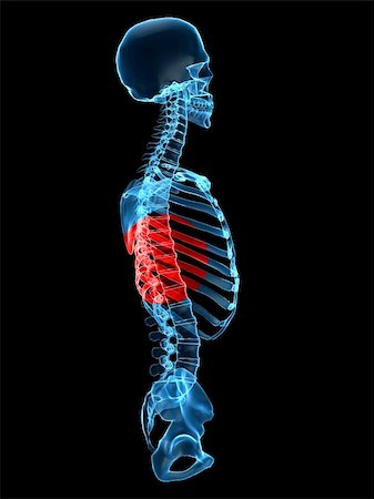 simsearch:400-05715953,k - 3d rendered x-ray  illustration of a human torso with a painful spine Stock Photo - Budget Royalty-Free & Subscription, Code: 400-04008302