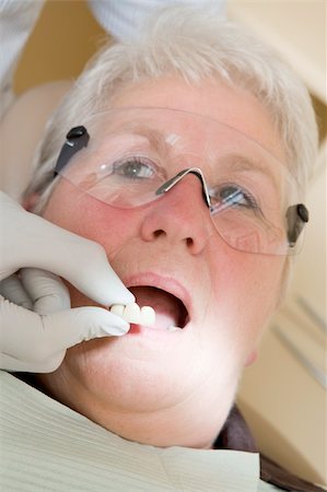 surgery tray - Dentist in exam room fitting dentures on woman in chair Stock Photo - Budget Royalty-Free & Subscription, Code: 400-04044357