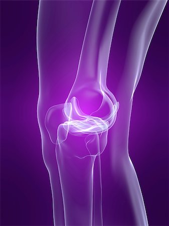 pink science - 3d rendered x-ray illustration of a human skeletal knee Stock Photo - Budget Royalty-Free & Subscription, Code: 400-04048601