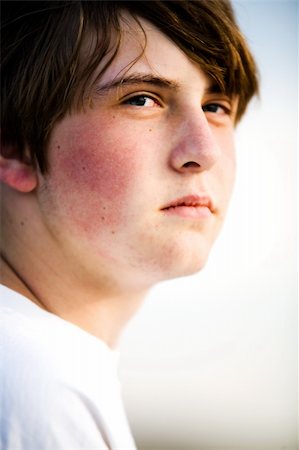 rosy cheeks - teenager male portrait, natural look, natural light Stock Photo - Budget Royalty-Free & Subscription, Code: 400-04059424