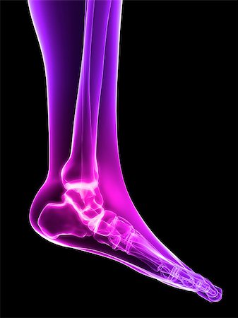 3d rendered x-ray illustration of a human painful foot Stock Photo - Budget Royalty-Free & Subscription, Code: 400-04053416