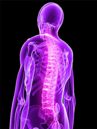 simsearch:400-04008303,k - 3d rendered x-ray illustration of a painful human back Stockbilder - Microstock & Abonnement, Bildnummer: 400-04053418
