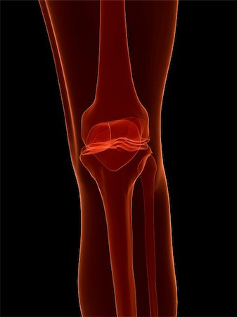 simsearch:400-07088080,k - 3d rendered x-ray illustration of a human skeletal knee Stock Photo - Budget Royalty-Free & Subscription, Code: 400-04065662