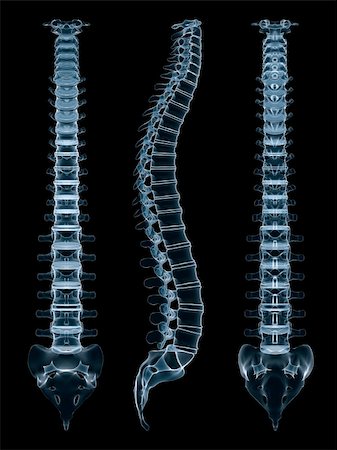 3d rendered anatomy illustration from different views of a human spine Fotografie stock - Microstock e Abbonamento, Codice: 400-04068188