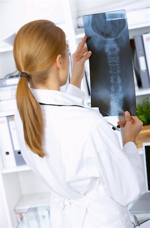 simsearch:400-04178933,k - Doctor examining x-ray picture in her surgery Stock Photo - Budget Royalty-Free & Subscription, Code: 400-04075528