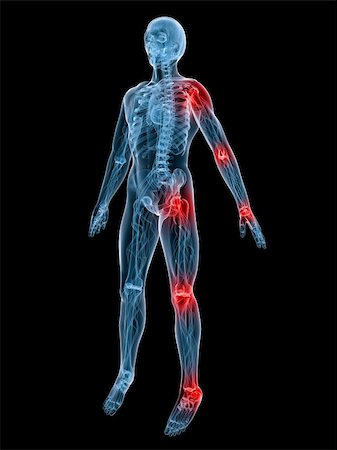simsearch:400-04008303,k - 3d rendered illustration of a human anatomy with painful joints Stockbilder - Microstock & Abonnement, Bildnummer: 400-04071183